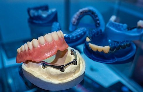 Denture at lab