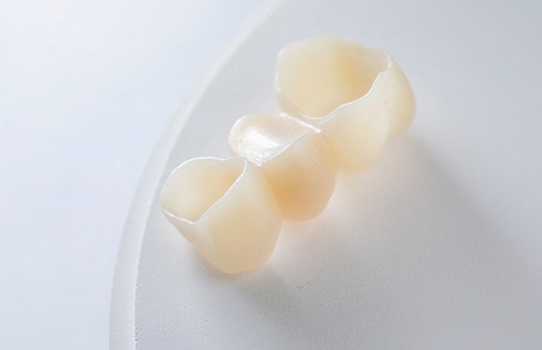 Upside-down dental bridge to show crowns on each end