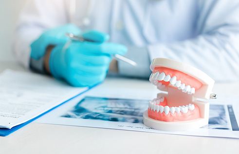 Dentist’s gloved hands on desktop looking over patient’s X-rays next to model teeth